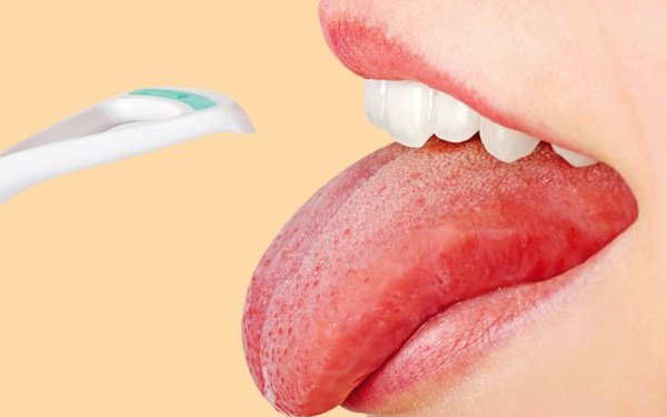 Khi nào bạn cần điều trị u máu ở lưỡi?